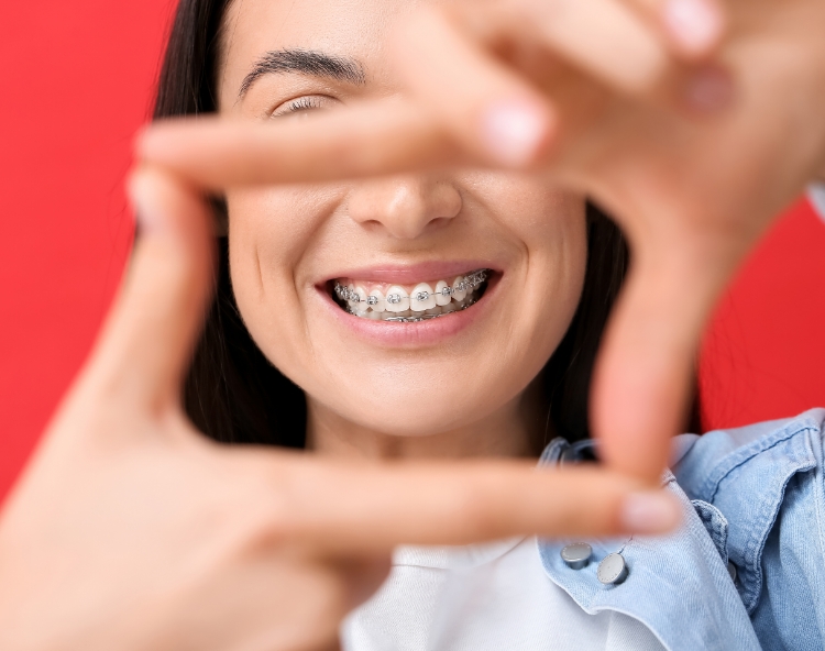 Orthodontic Treatment